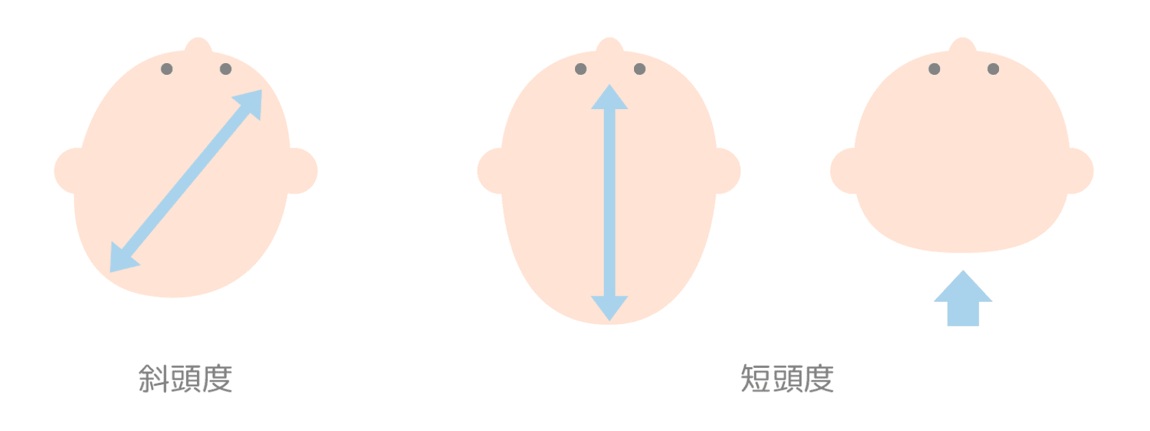 頭の形のゆがみの種類